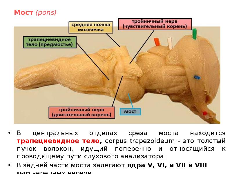 Трапециевидное тело