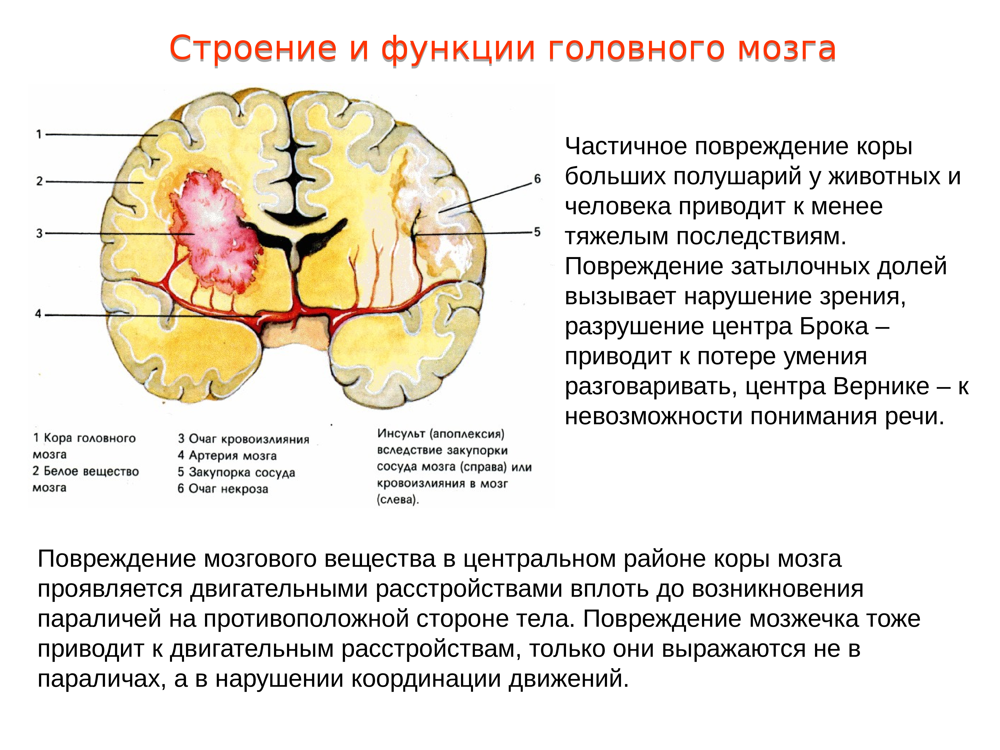Поражение мозга последствия. Локальное повреждение коры головного мозга. Повреждения затылочной доли мозга. Повреждение коры больших полушарий головного мозга.
