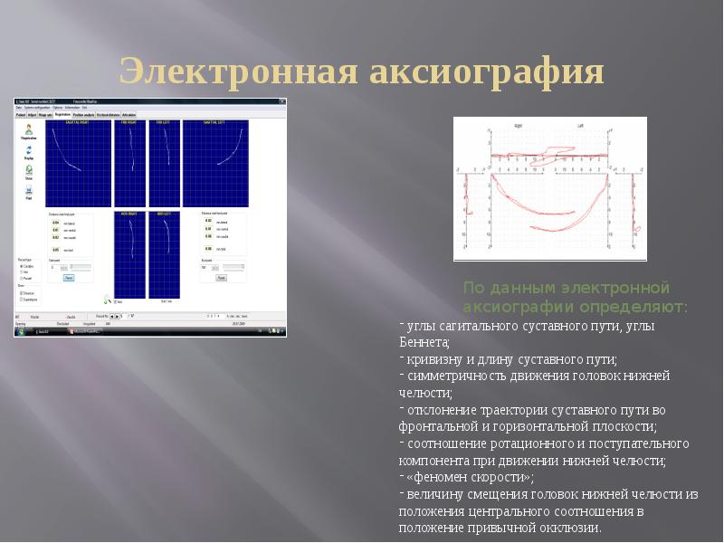 Клинический случай ортопедическая стоматология презентация