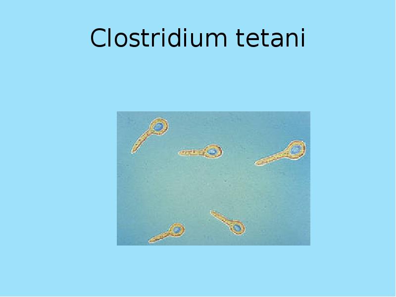 Clostridium tetani номенклатура. Clostridium tetani специальные методы окраски.