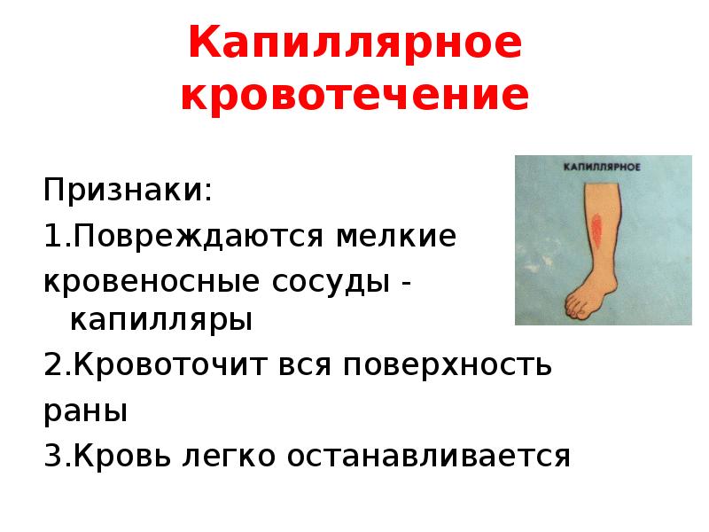 Характеристика кровотечений