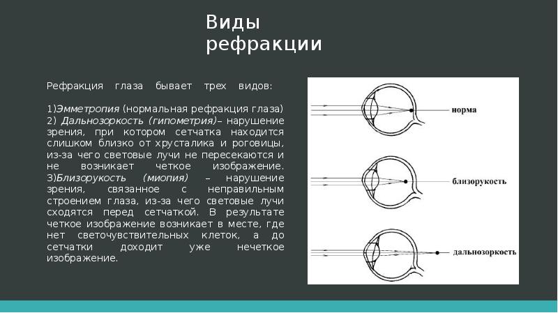 Рефракция. Эмметропия рефракция. Клиническая рефракция глаза. Понятие рефракции. Рефракция глаза у эмметропа.