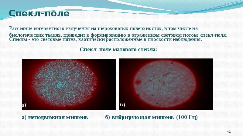 Спекл шум на изображении