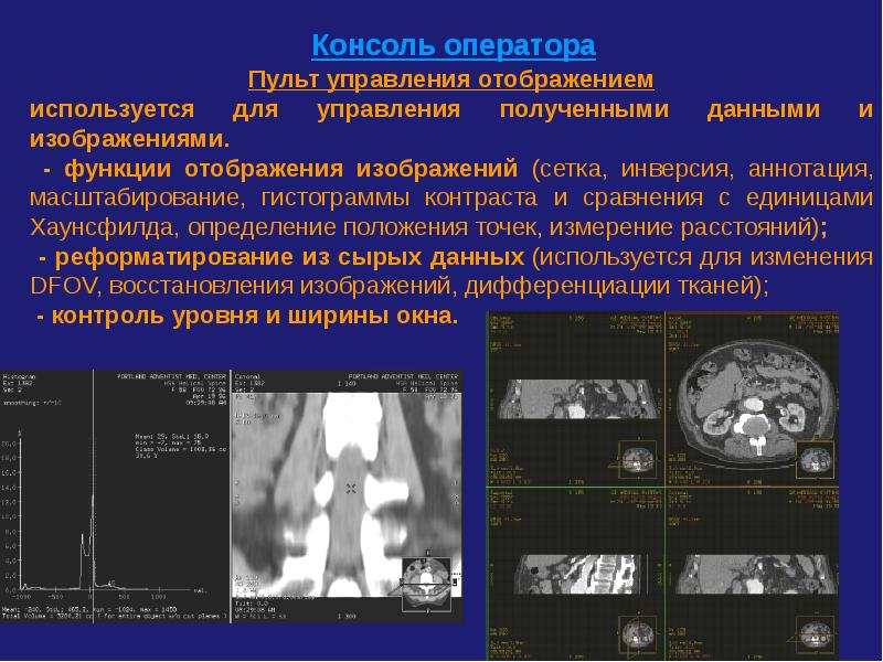 Компьютерная томография презентация