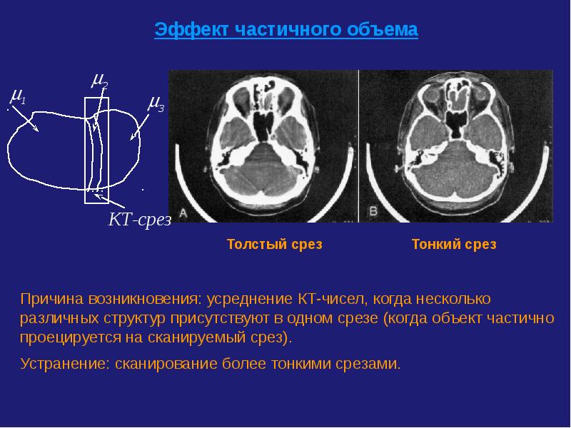 Mip изображение кт