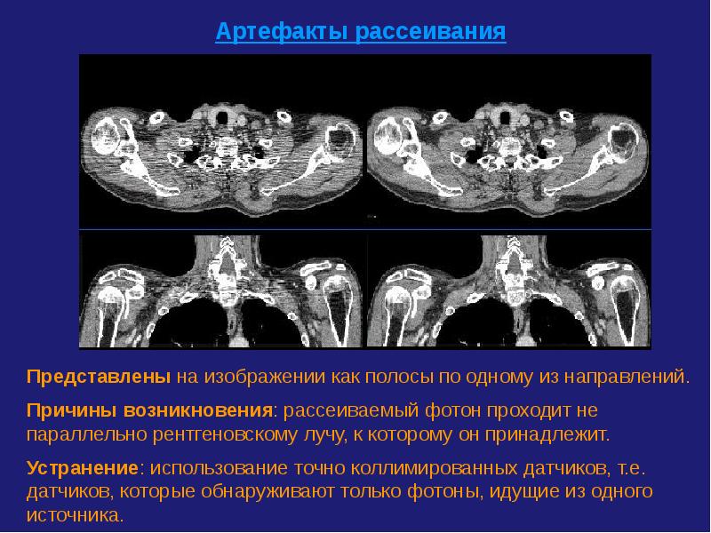 Компьютерная томография презентация