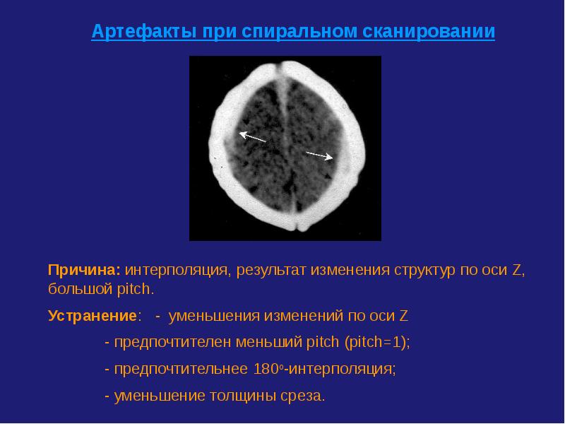 Что такое кт презентация