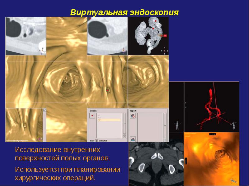 Компьютерная томография презентация