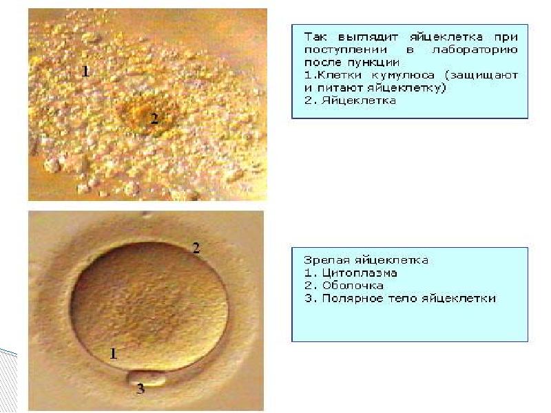 Процессы происходящие в яичниках. Донор женской яйцеклетки. Донор ооцитов. Можно ли сдавать яйцеклетки. Донация ооцитов.