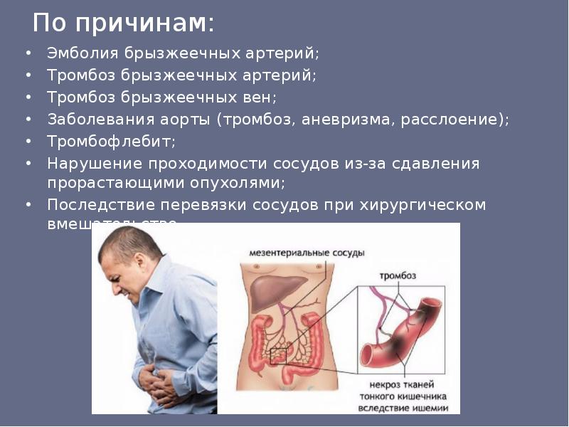 Мезентериальный тромбоз карта вызова скорой медицинской