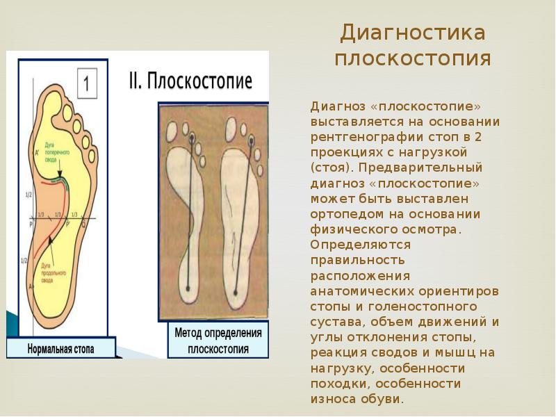 Лабораторная работа по биологии плоскостопие. Биология 8 класс плоскостопие лабораторная. Лаб раб по биологии 8 класс выявление плоскостопия. Выявление плоскостопия биология. Выявление плоскостопия вывод.