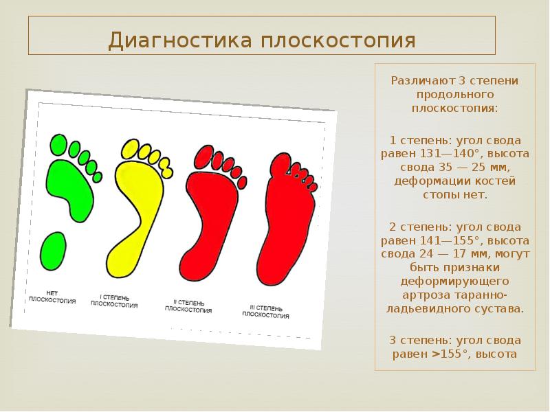 Рассмотрите рисунок с изображением стопы человека как называют нарушение формы