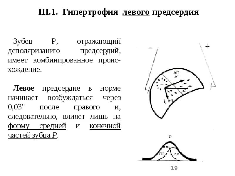 Гипертрофия значение. ЭКГ при гипертрофиях различных отделов сердца. ЭКГ при гипертрофии отделов сердца презентация. Гипертрофия левого предсердия рентген. Деполяризация при гипертрофии правого предсердия.