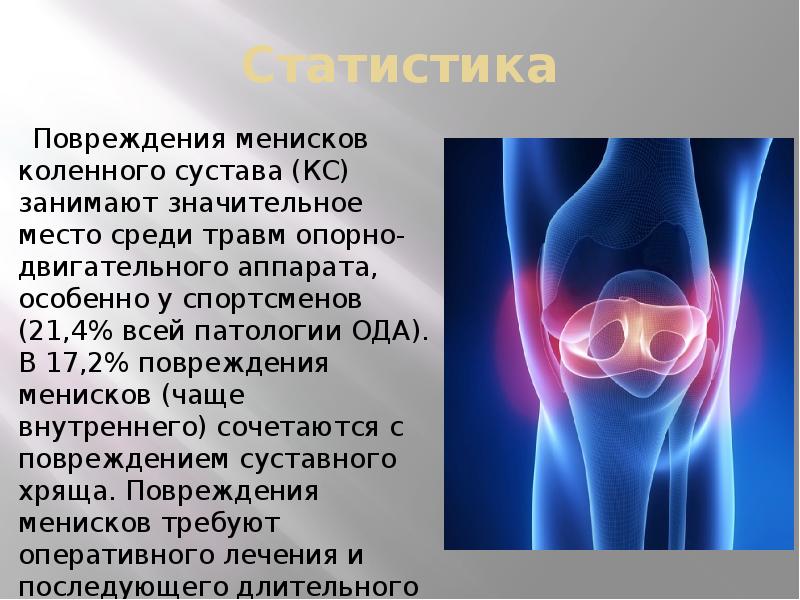 Повреждение коленного сустава презентация