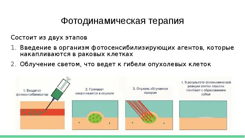 Фотодинамическая диагностика презентация