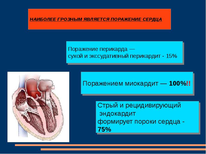 Эндокардит миокардит перикардит презентация