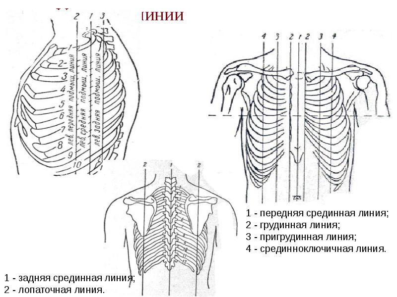 Условные линии