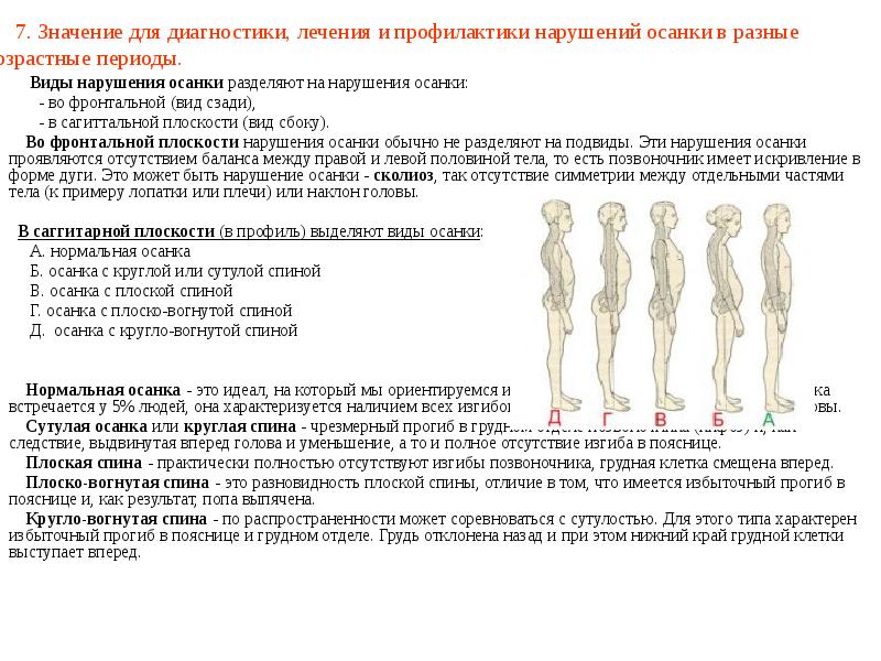 7. Значение для диагностики, лечения и профилактики нарушений осанки в разные