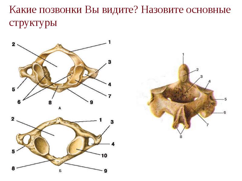 Какие позвонки Вы видите? Назовите основные структуры