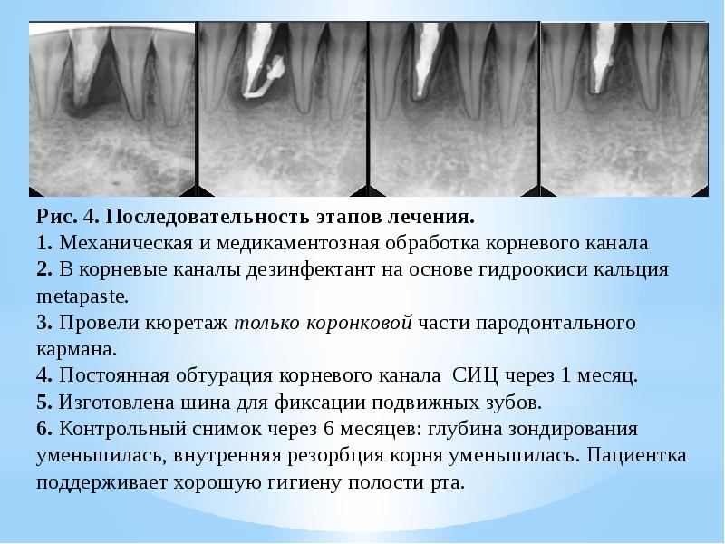 Общие принципы пародонтальной хирургии презентация