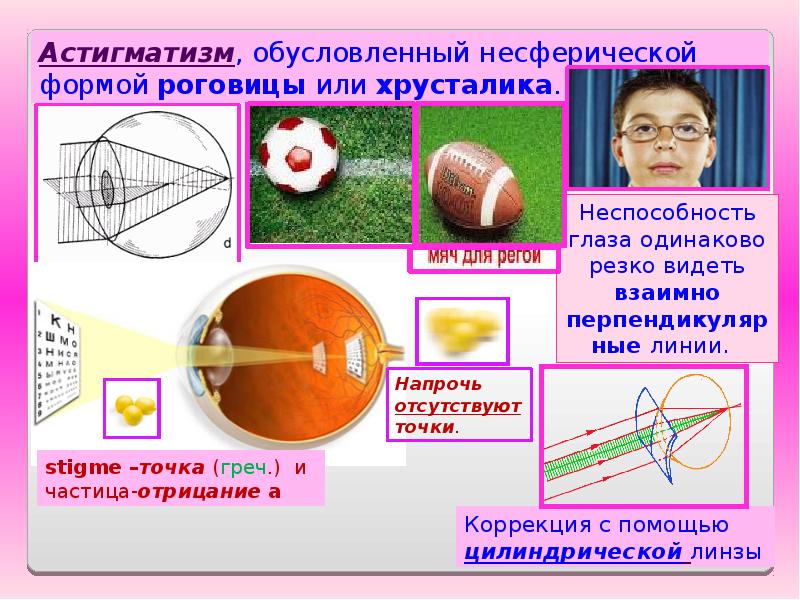 Астигматизм простыми словами