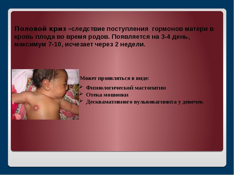 врожденный гипотиреоз щитовидная железа. врожденный гипотиреоз у детей симптомы. норма гормонов щитовидной железы у детей 5 лет. гормоны у новорожденных. транзиторный гипотиреоз у новорожденных.