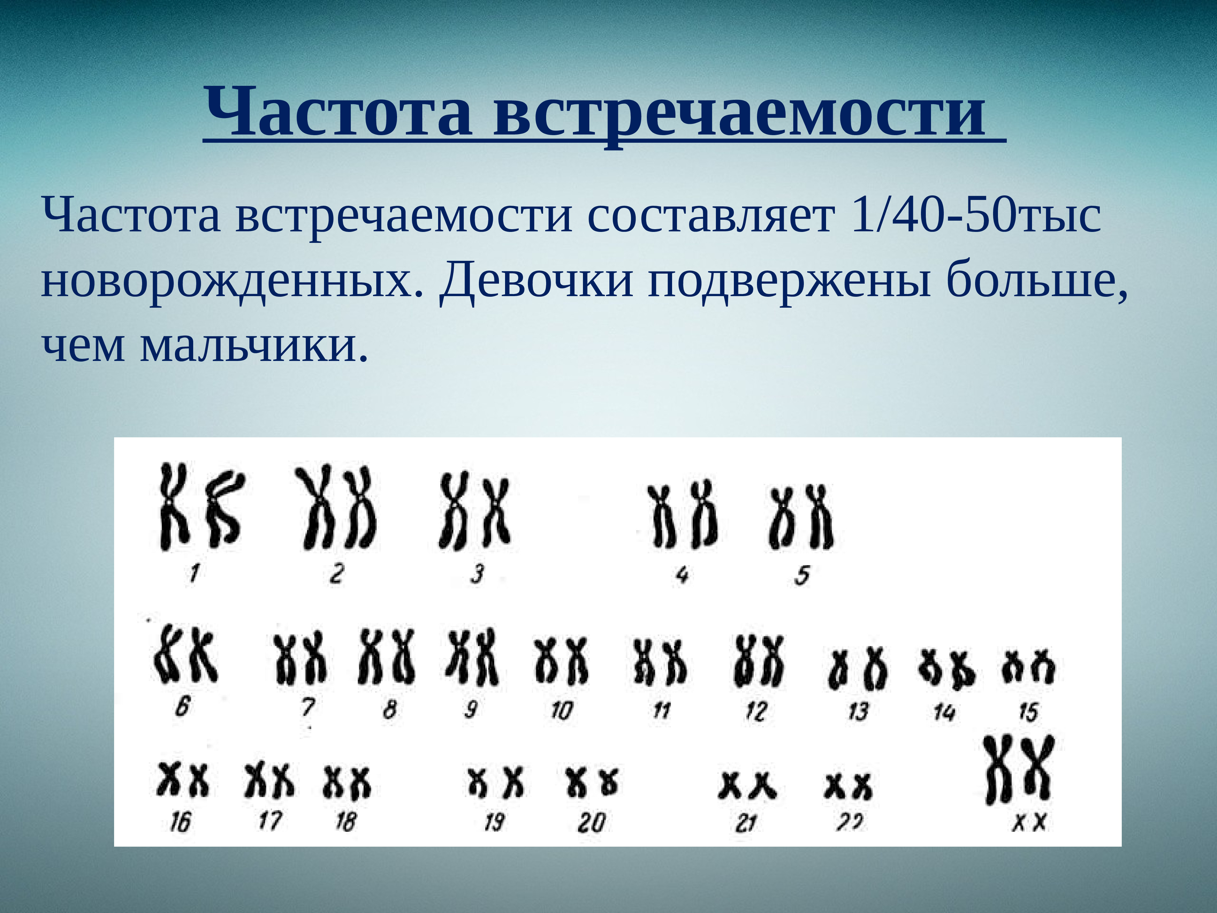 Презентация на тему синдром кошачьего крика