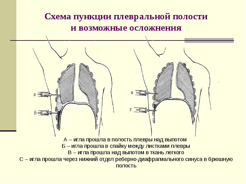 Протокол плевральной пункции образец