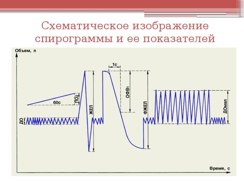 Что такое спирография. Спирограмма. Спирограмма легких. Схема спирограммы. Схематическое изображение спирограммы.