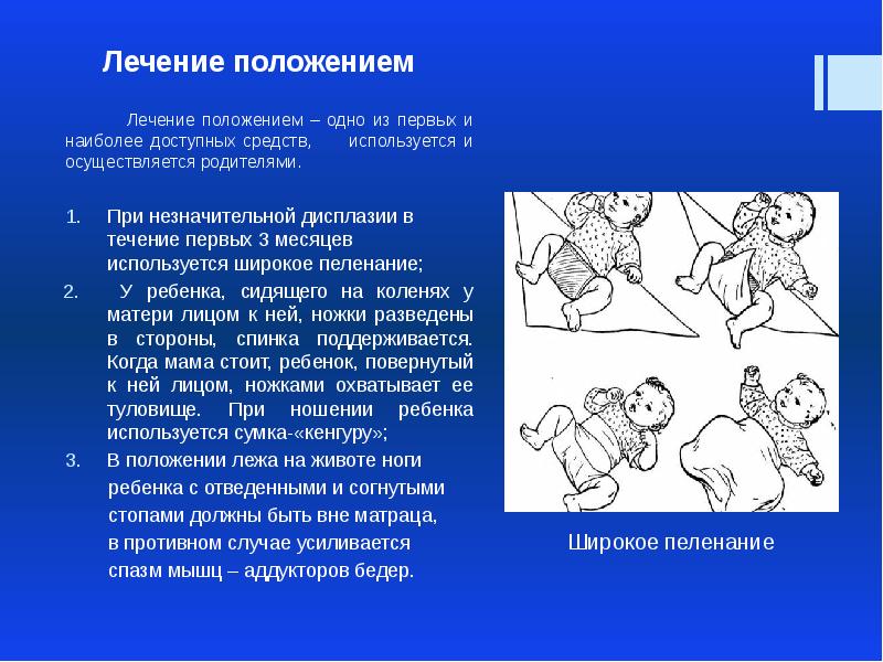 Лечение положением. Методика лечение положением. Лечение положением презентация. Лечение положением используется при.