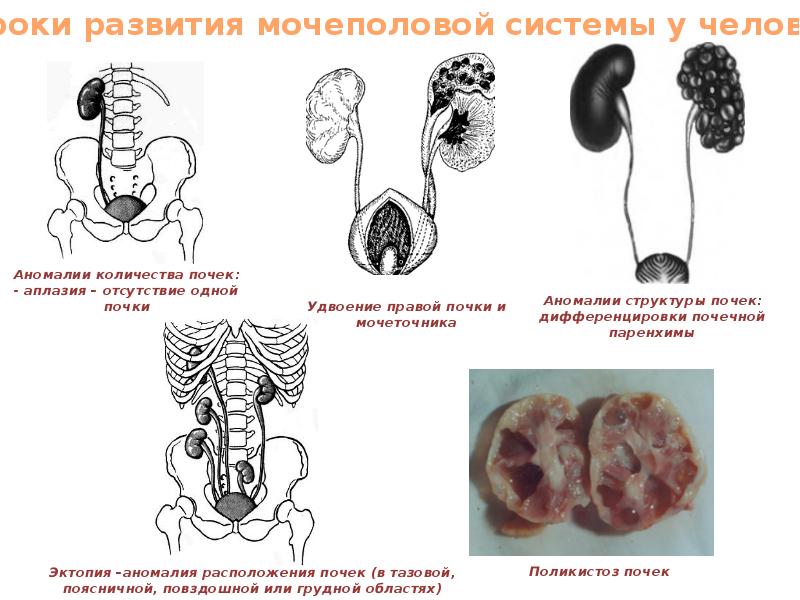 Филогенез выделительной системы презентация