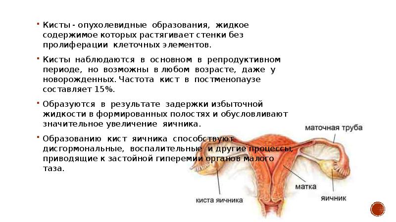 Схема лечения кисты яичника