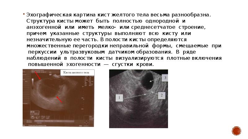 Эхографическую картину кисты поджелудочной железы необходимо дифференцировать с тест