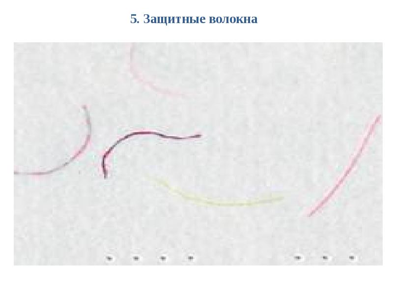 5. Защитные волокна 5. Защитные волокна