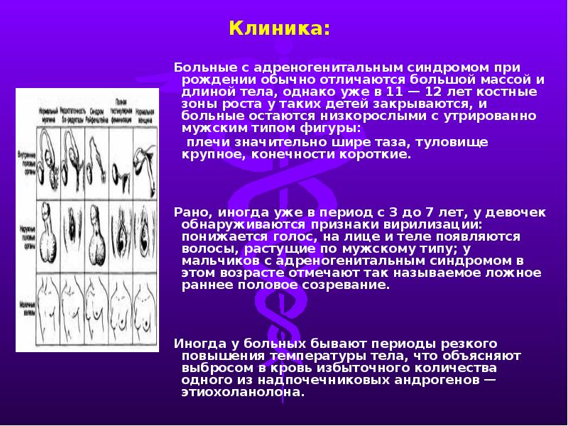 Адреногенитальный синдром у детей презентация