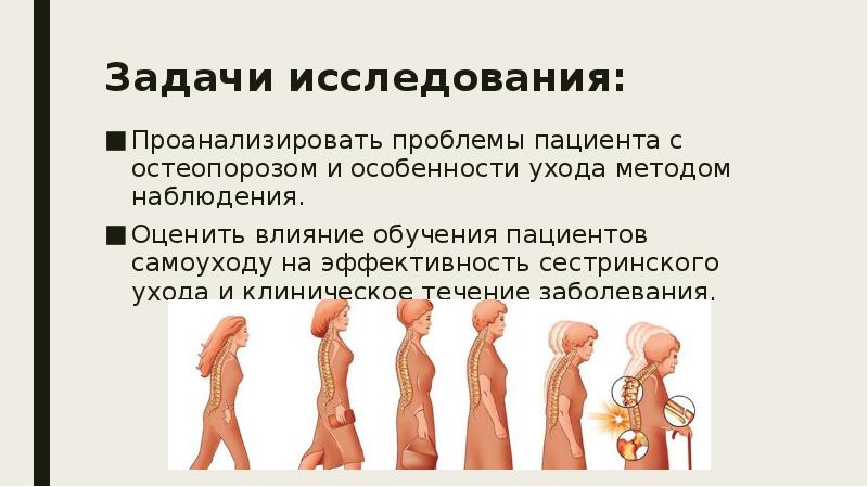 Профессиональная деятельность медицинской сестры при лечении остеопороза