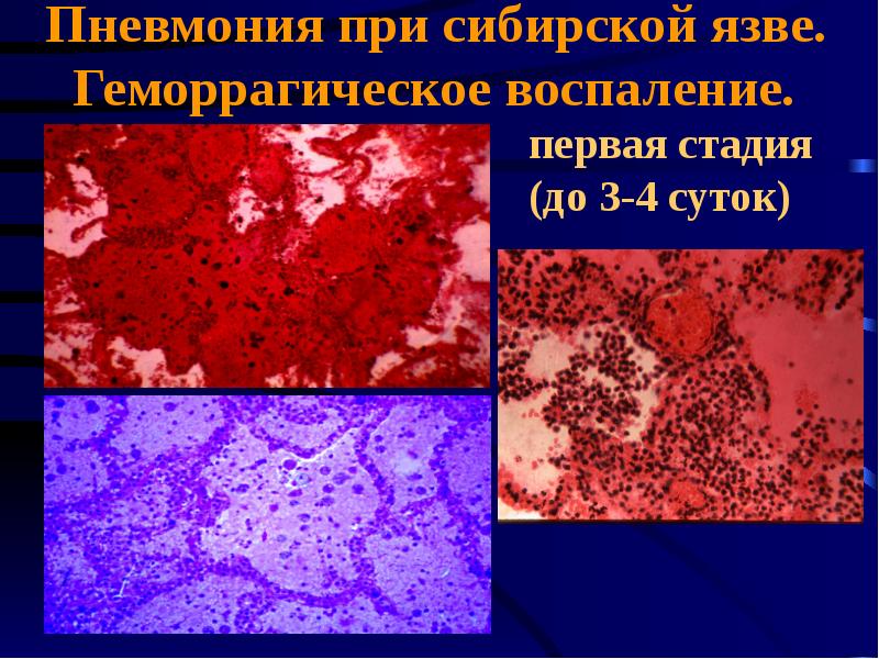 Ревматические болезни патанатомия презентация