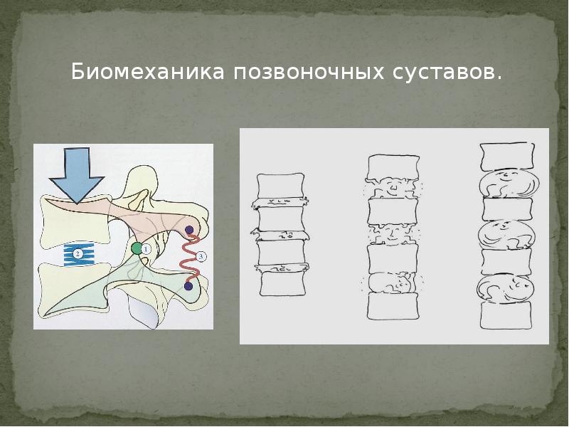 Презентация про остеохондроз