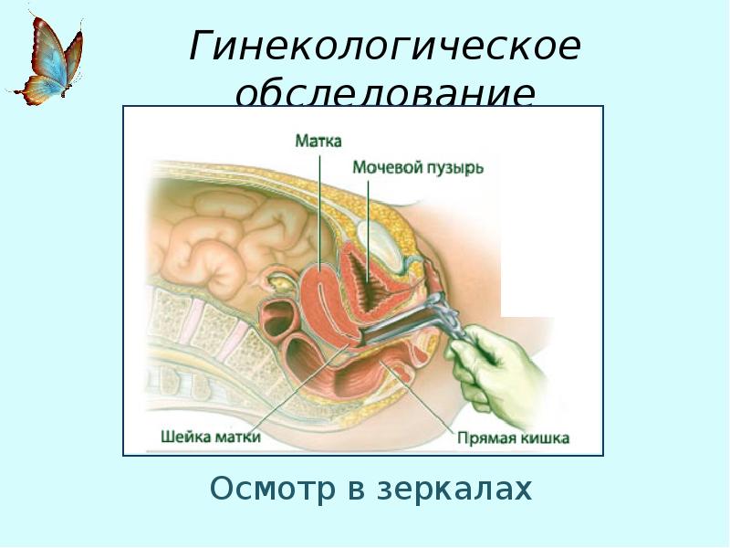 Методы обследования в гинекологии презентация