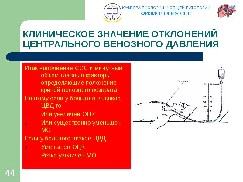 Венозное давление. Методика измерения центрального венозного давления. Периферическое венозное давление это. Венозное давление физиология. Аппарат Вальдмана для определения ЦВД.