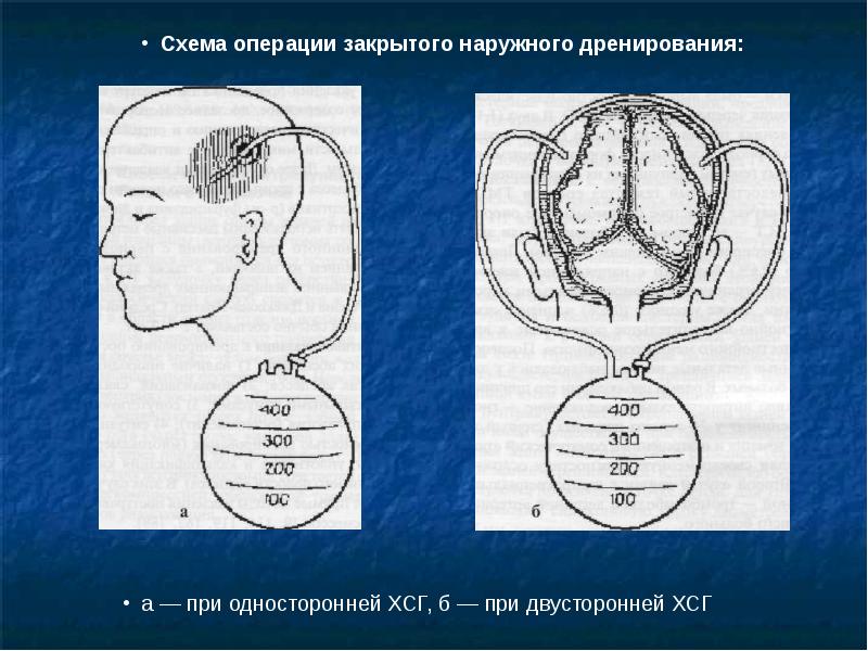 Схема кренлейна для чего