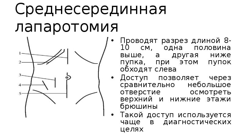 Анатомия брюшной стенки в гинекологии. (Резидент КазНМУ им. С.Д. Асфендиярова Гасанов А.)