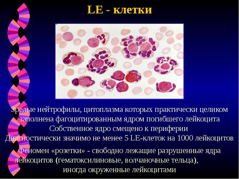 LE - клетки LE - клетки