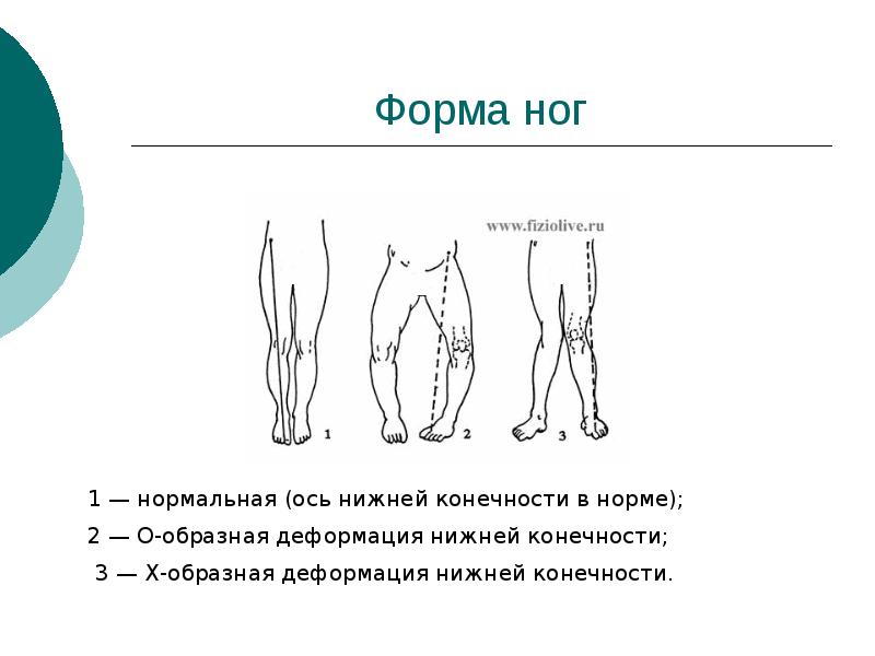 характеристика внешних форм конечностей. брахиморфное телосложение тип конституции. разная форма ног. типы строения ног. характеристика внешних форм конечностей.