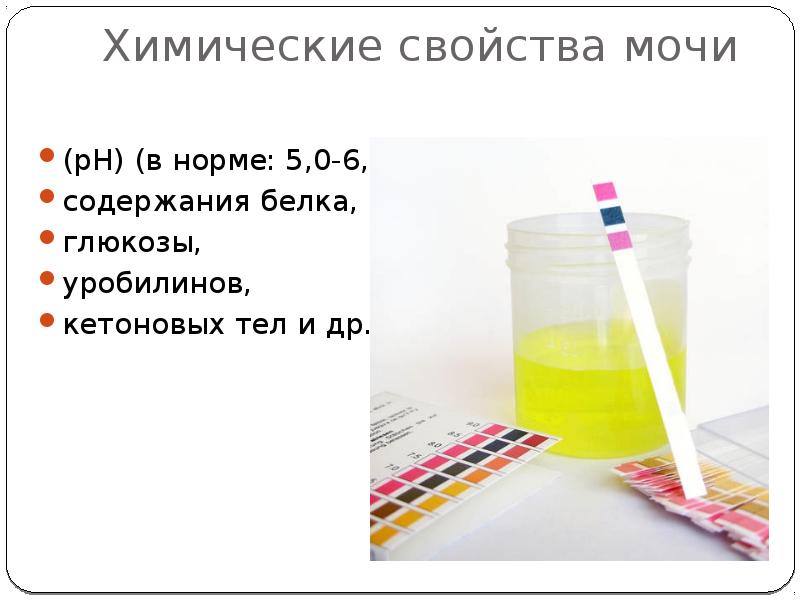 Анализ мочи картинки для презентации