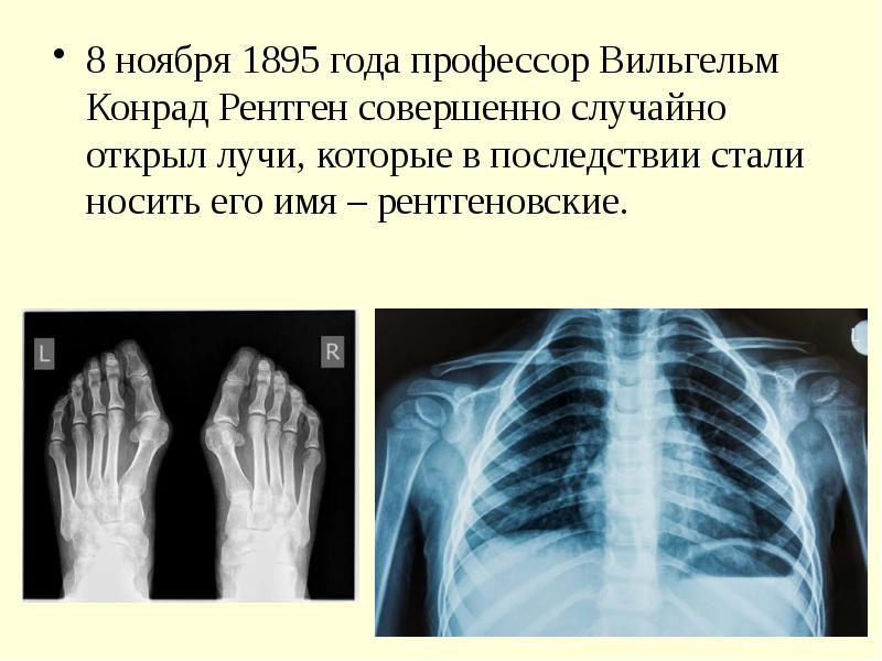 Шаблоны презентаций рентген