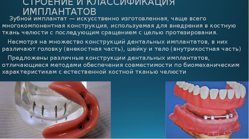 Профилактика и лечение осложнений стоматологической имплантации презентация