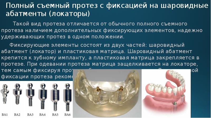 Особенности протезирования с использованием различных систем имплантатов презентация