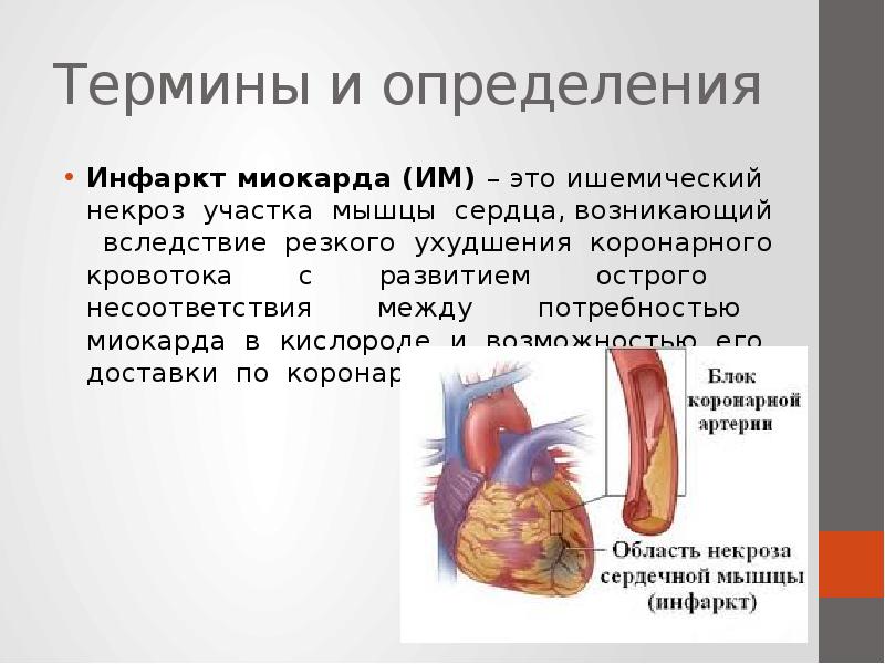 Как определить сердечный приступ