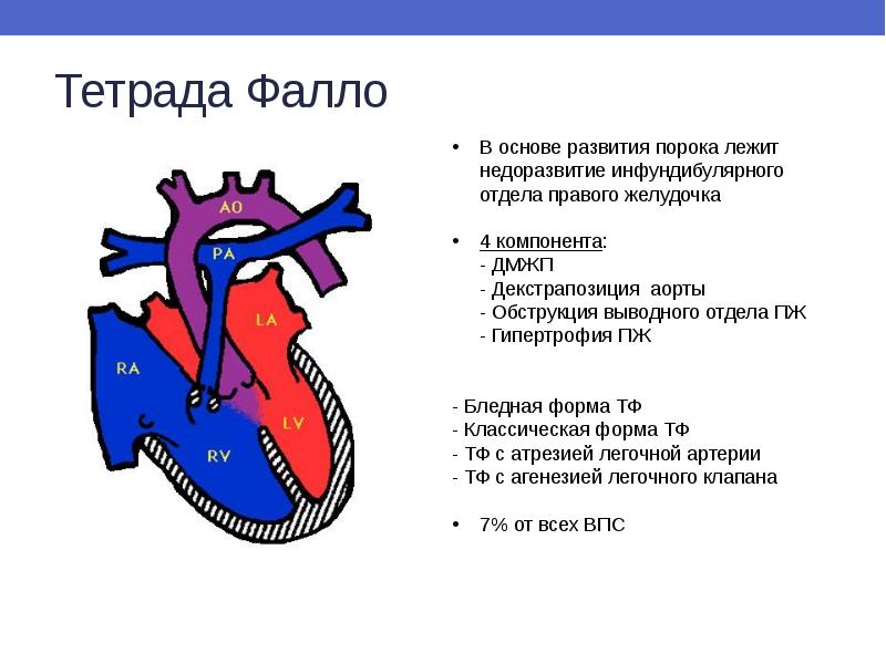 Врожденные пороки развития сердца презентация